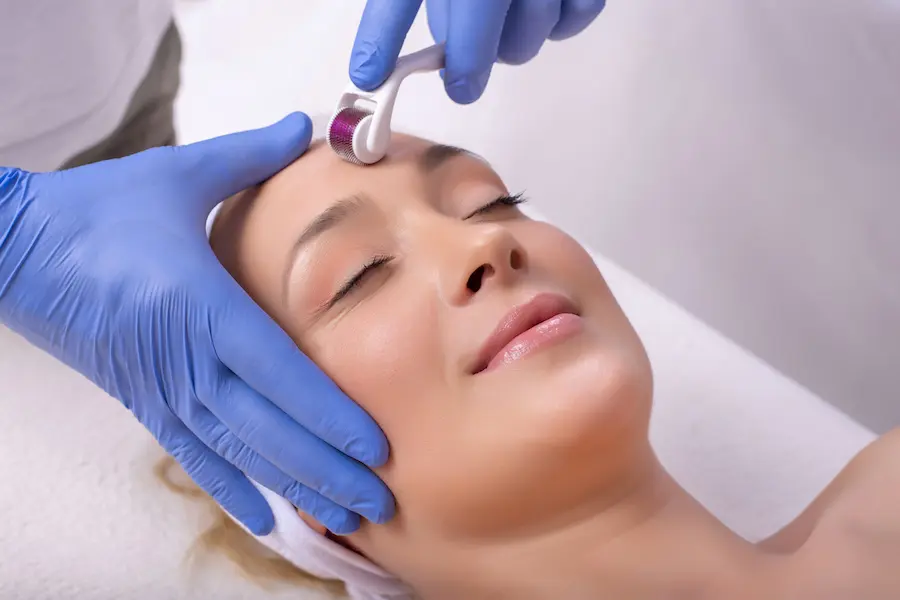 Vivace Microneedling